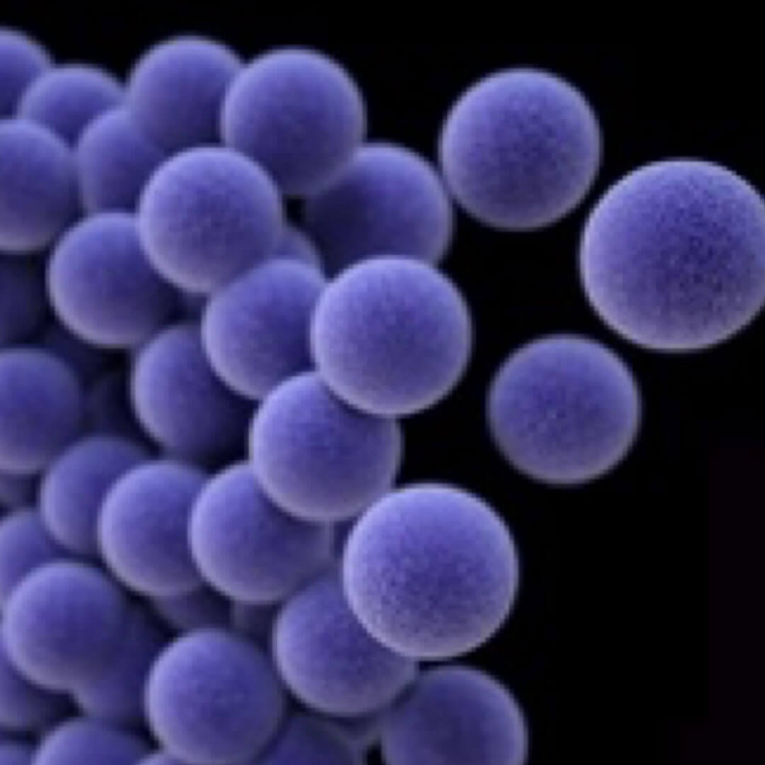 Staphylococcus Aureus