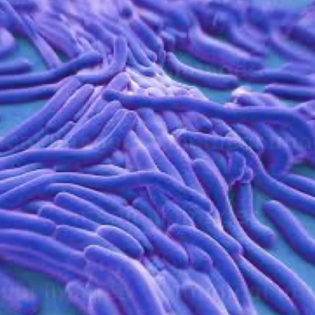Legionella
