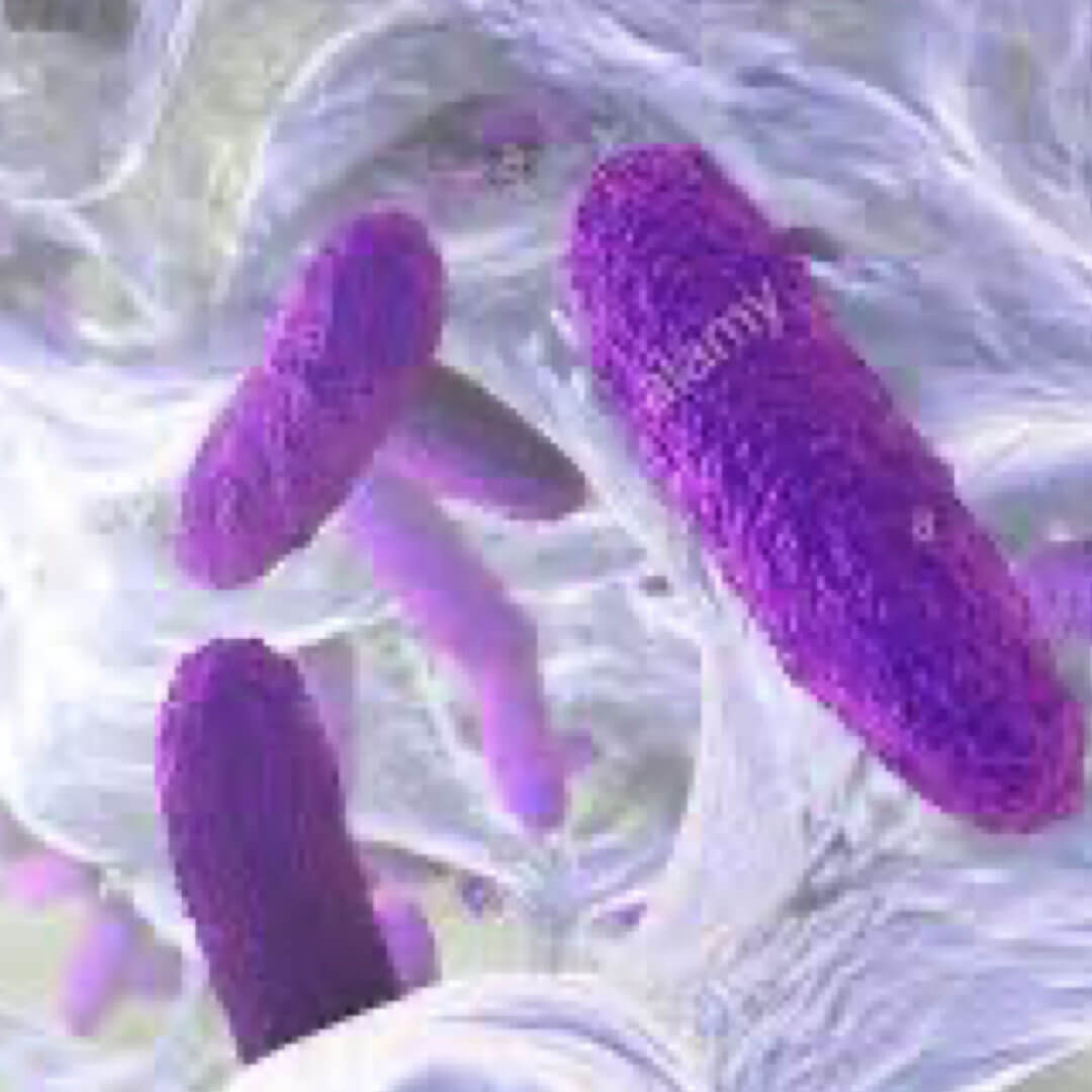 E. Coli, Klebsiella Sp., Serratia Sp., Citrobacter Sp., Proteus Sp., Enterobacter Sp.