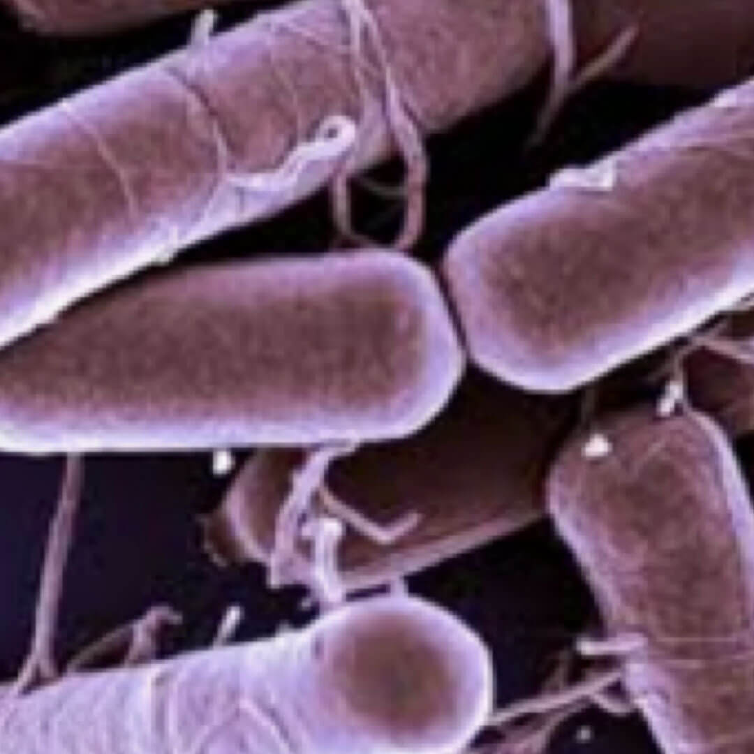Bacillus Sp. (Aerobic Spore Producers)