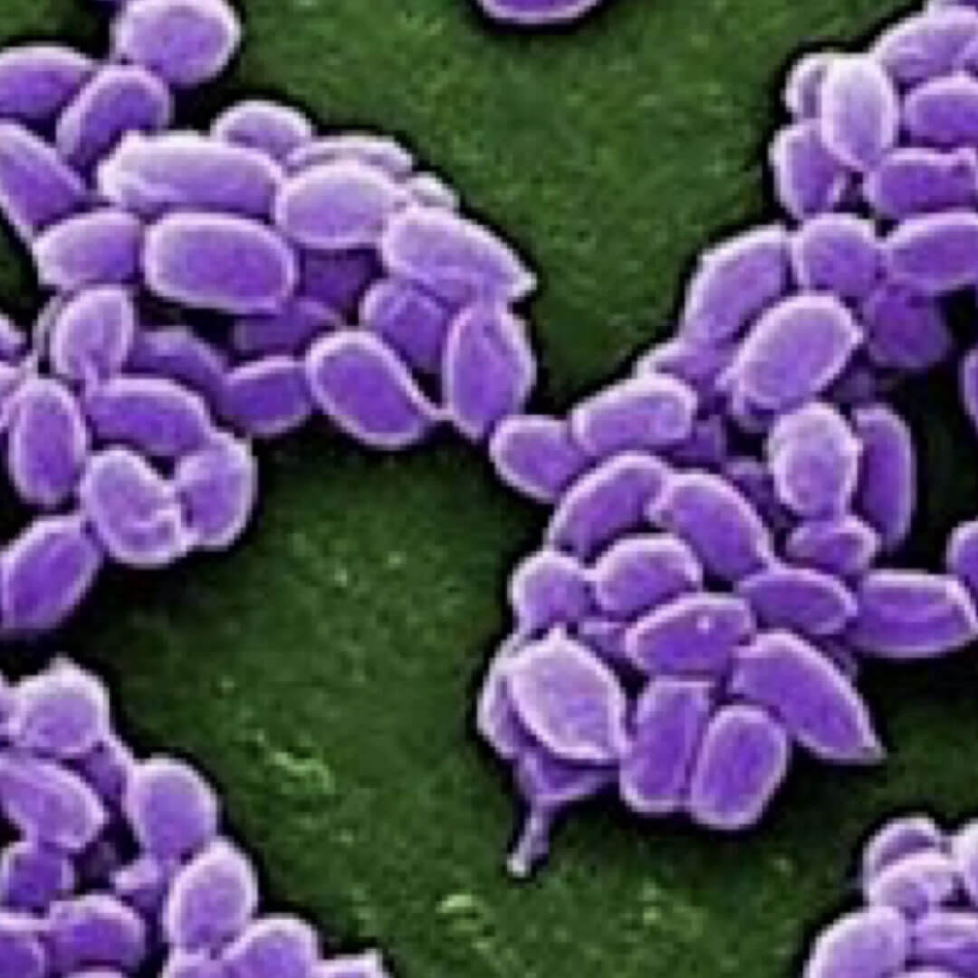 Streptococcus Sp.